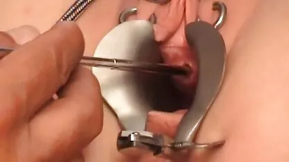 Esposa-z ouvir o pessoal melhores videos sexo gratis